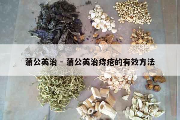 蒲公英治 - 蒲公英治痔瘡的有效方法