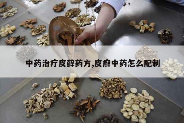 中藥治療皮蘚藥方,皮癬中藥怎么配制